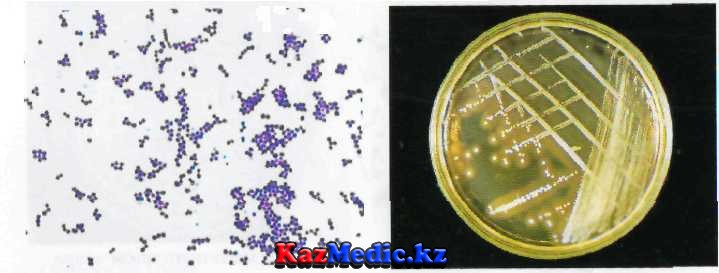 Staphylococcus aureus қазаққша