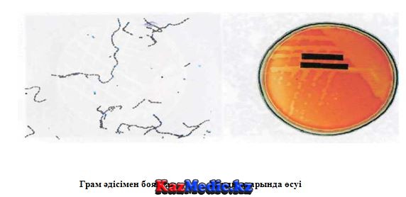 Streptococcus pyogenes стафилокок қазақша