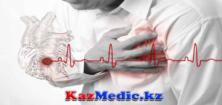 Инфаркт миокарда на казахском thumbnail