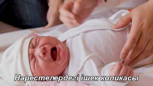 Нәрестелердегі ішек түйілуі. Колика