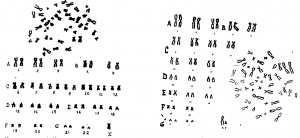 Хромосомның ххy синдромы