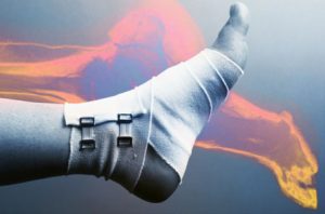 Тірек қимыл жүйесіннің аурулары мен зақымдануындағы қарау ерекшеліктері.