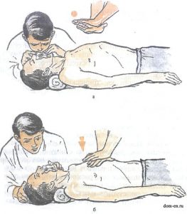 Жасанды тыныс беру тәсілдері, қолданылуы.