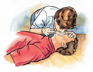 Жасанды тыныс беру тәсілдері, қолданылуы.