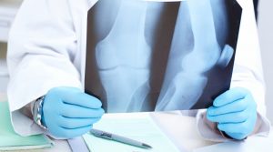 Тірек қимыл жүйесіннің аурулары мен зақымдануындағы қарау ерекшеліктері.