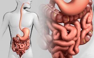 Тітіркенген ішек синдромы