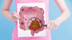 Тітіркенген ішек синдромы