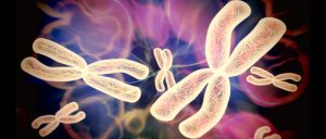 Хромосоманың Х моносомия синдромы (Шершевский-Тернер синдромы, Тернер синдромы,ХО- синдромы)