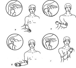 Сан сүйегінің шығулары.