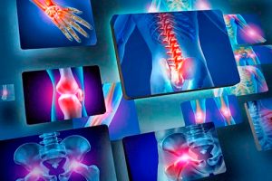 Сан зақымдалуы.