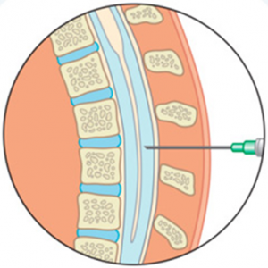 Инвазивті зерттеу әдістері