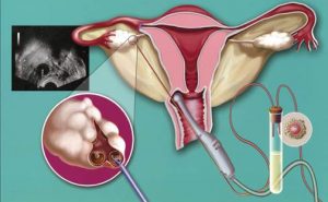 Инвазивті зерттеу әдістері