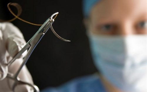 Жібек жіпті зарарсыздандыру әдістері