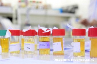 Методы исследования мочи по зимницкому. Контейнер для сбора мочи по зимницкому. Баночки по зимницкому. Зимницкого проба зимницкого. Проба мочи по зимницкому методика исследования.