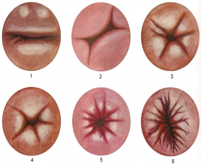 Форма половых губ персик щавель фото. Формы женских половых губ. Форма половых губ разная форма. Половые губы разные типы.