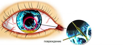 Қабақ жарақаты