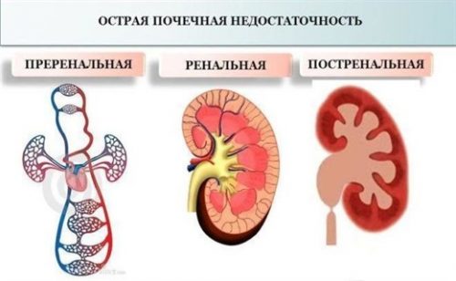 Тубулопатиялар